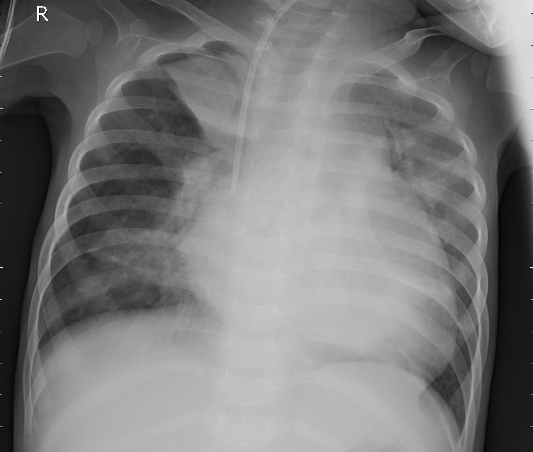 Original comparison reference